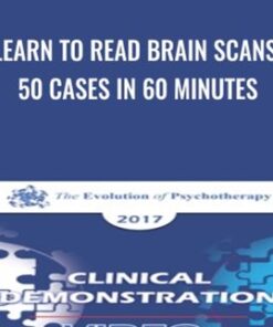 Learn to Read Brain Scans: 50 cases in 60 Minutes - Daniel Amen