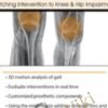 Total Joint Rehabilitation: Matching Intervention to Knee & Hip Impairment - Chad M. Thompson