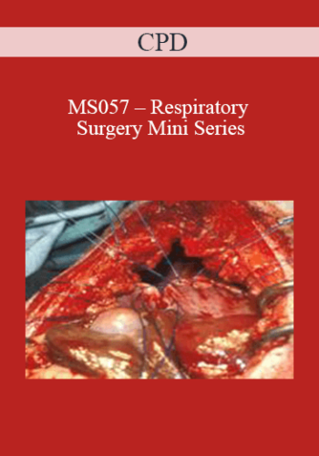 CPD - MS057 – Respiratory Surgery Mini Series