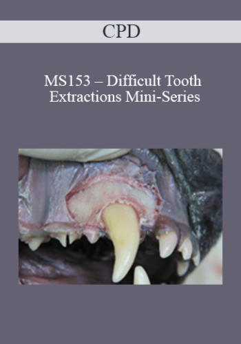 CPD – MS153 – Difficult Tooth Extractions Mini-Series