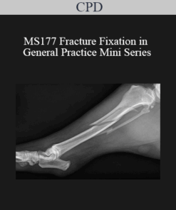 CPD - MS177 Fracture Fixation in General Practice Mini Series