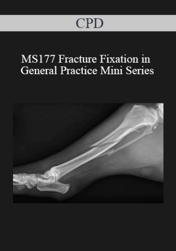 CPD - MS177 Fracture Fixation in General Practice Mini Series