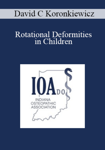 David C Koronkiewicz - Rotational Deformities in Children