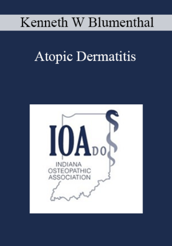 Kenneth W Blumenthal – Atopic Dermatitis