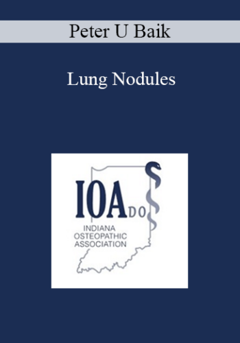 Peter U Baik – Lung Nodules